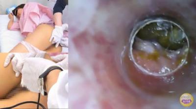 隠撮 騙し浣腸治験モニター4